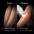 LumiSilk IPL Pro™