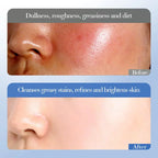 Crema Facial Hidratante Profunda – Iluminadora con Niacinamida y Arroz (50g)